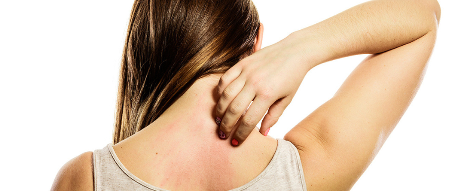 Diabetes and Skin Complications